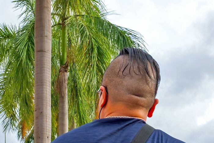 35 Lucky Accidents Captured By Street Photographer Edas Wong (New Pics)