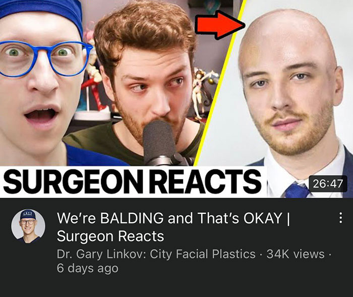 This Thumbnail. You Can Still See His Hair