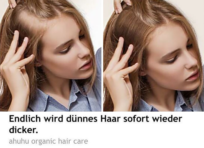 Easily Cured Baldness