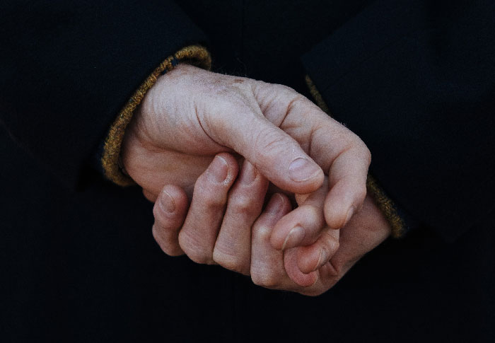 25 Personas que no tuvieron suerte en el reparto de los genes