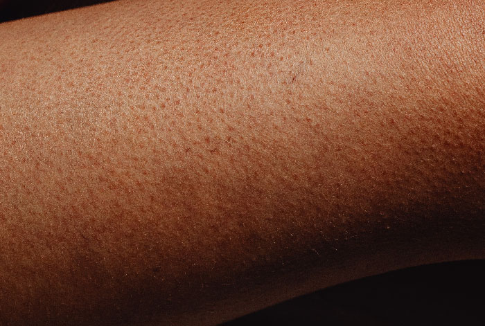 25 Personas que no tuvieron suerte en el reparto de los genes