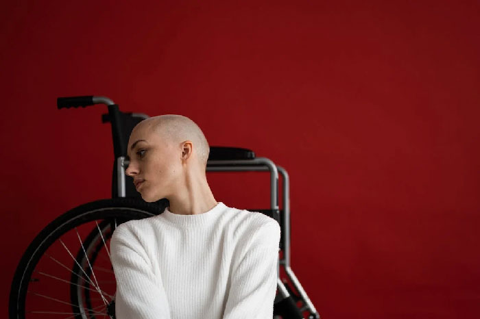 25 Personas que no tuvieron suerte en el reparto de los genes