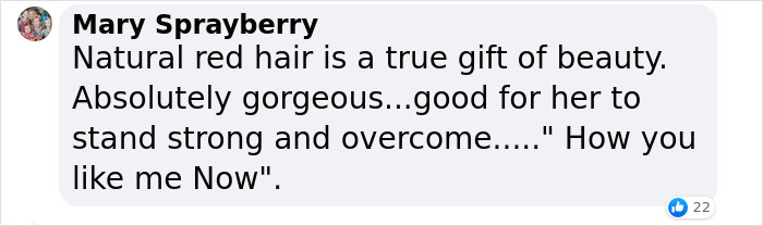 Woman Who Was “Spat At” And “Burned” At School For Having Ginger Hair Grows Up To Be Crowned Miss England Woman Who Was “Spat At” And “Burned” At School For Having Ginger Hair Grows Up To Be Crowned Miss England