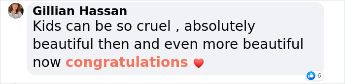 Woman Who Was “Spat At” And “Burned” At School For Having Ginger Hair Grows Up To Be Crowned Miss England Woman Who Was “Spat At” And “Burned” At School For Having Ginger Hair Grows Up To Be Crowned Miss England