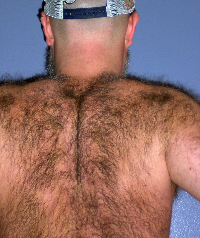 25 Personas que no tuvieron suerte en el reparto de los genes