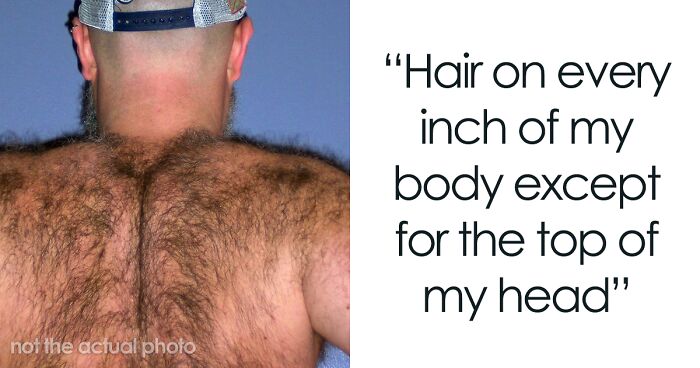 30 Times People Lost The Gene Lottery, According To This Viral Thread