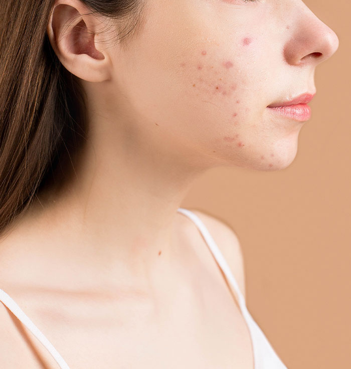 25 Personas que no tuvieron suerte en el reparto de los genes