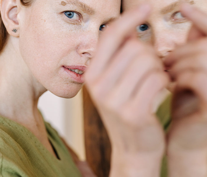 25 Personas que no tuvieron suerte en el reparto de los genes