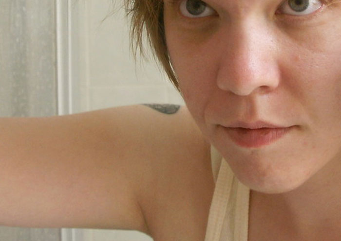 25 Personas que no tuvieron suerte en el reparto de los genes