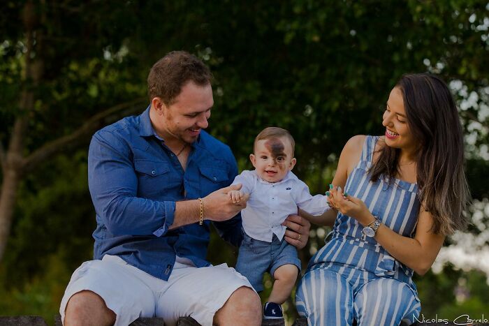 Societal Judgement Towards Enzo's Mark On His Face Encouraged His Mom To Replicate It On Hers To Walk In His Shoes