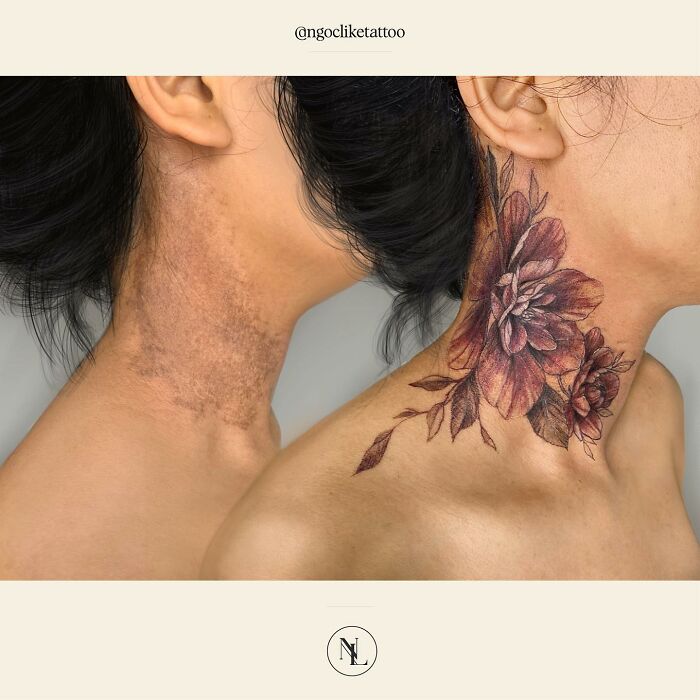 50 Times People Asked To Cover Up Their Scars, And This Tattoo Artist Nailed It (New Pics)