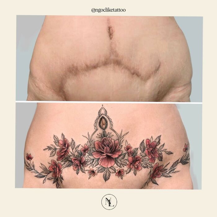 50 Times People Asked To Cover Up Their Scars, And This Tattoo Artist Nailed It (New Pics)