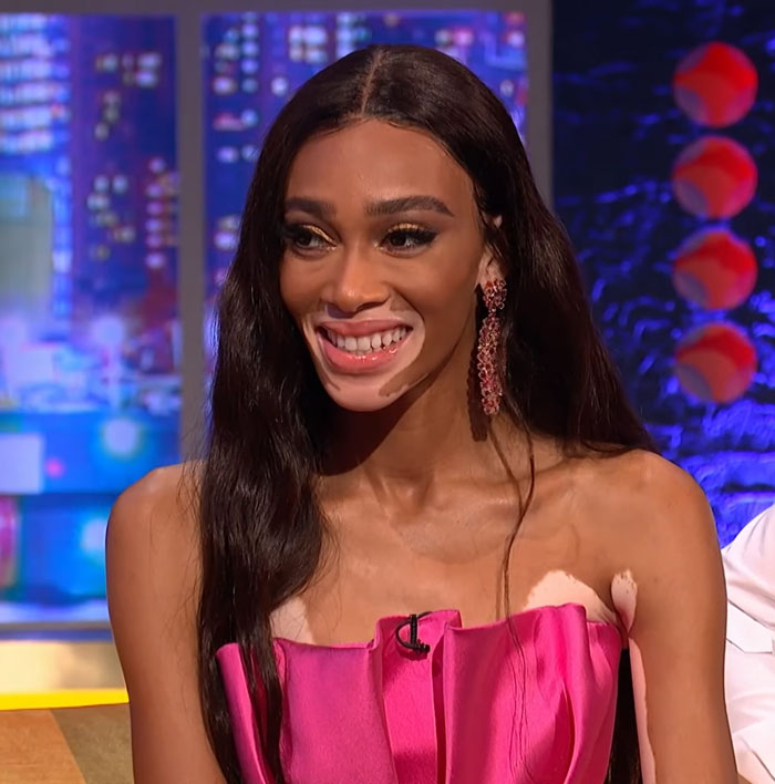 Winnie Harlow