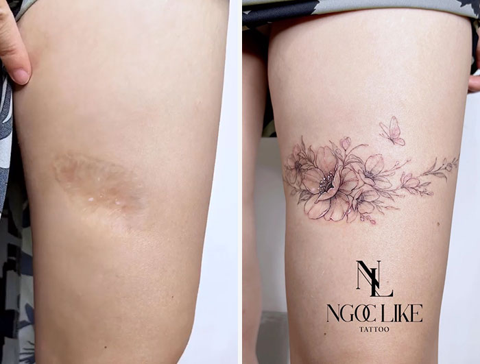 50 Times People Asked To Cover Up Their Scars, And This Tattoo Artist Nailed It (New Pics)