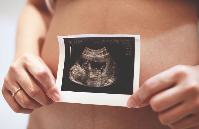 Woman Unexpectedly Gives Birth To A "Frat Baby" After Going To ER Thinking Her Appendix Is Bursting As She Had No Symptoms Woman Unexpectedly Gives Birth To A "Frat Baby" After Going To ER Thinking Her Appendix Is Bursting As She Had No Symptoms