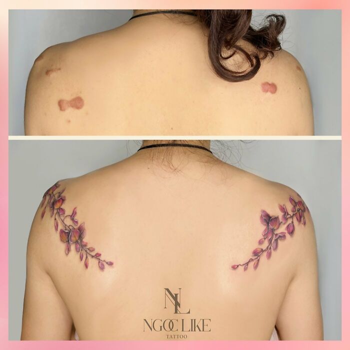 50 Times People Asked To Cover Up Their Scars, And This Tattoo Artist Nailed It (New Pics)