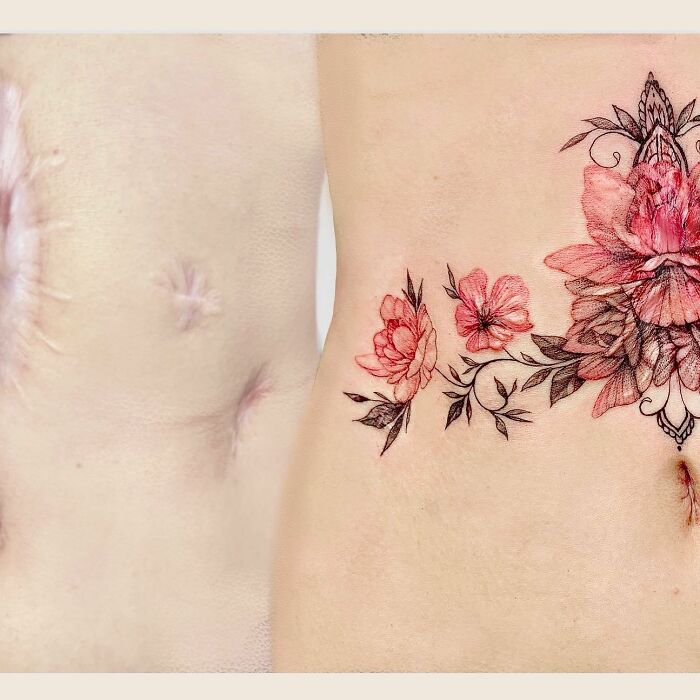 50 Times People Asked To Cover Up Their Scars, And This Tattoo Artist Nailed It (New Pics)