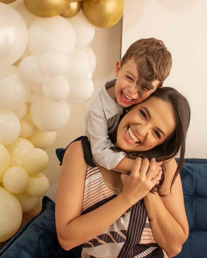 Societal Judgement Towards Enzo's Mark On His Face Encouraged His Mom To Replicate It On Hers To Walk In His Shoes