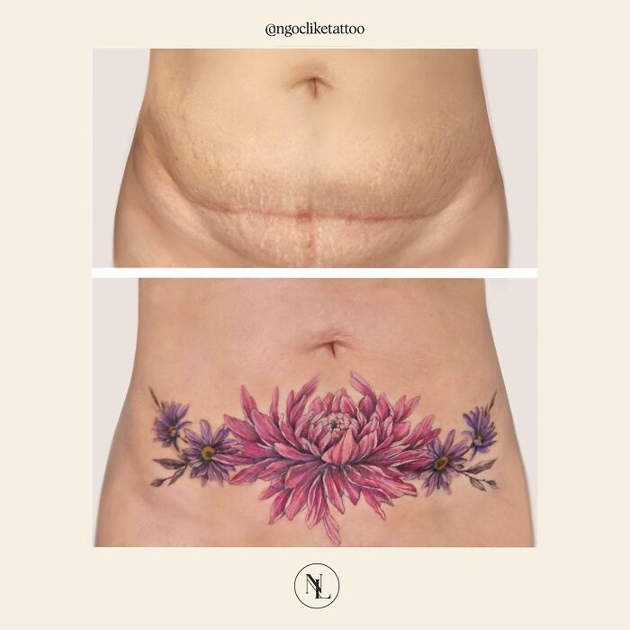 50 Times People Asked To Cover Up Their Scars, And This Tattoo Artist Nailed It (New Pics)