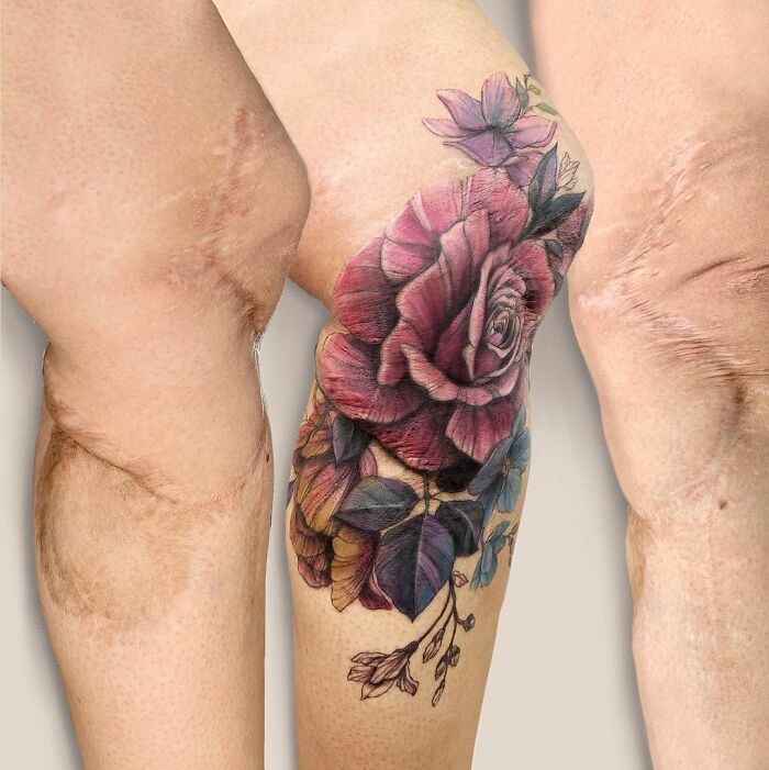 50 Times People Asked To Cover Up Their Scars, And This Tattoo Artist Nailed It (New Pics)