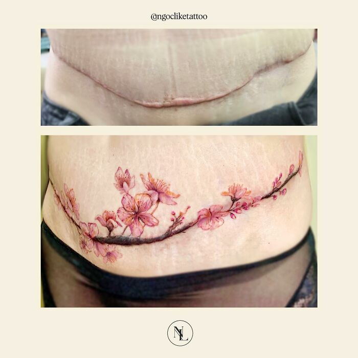 50 Times People Asked To Cover Up Their Scars, And This Tattoo Artist Nailed It (New Pics)