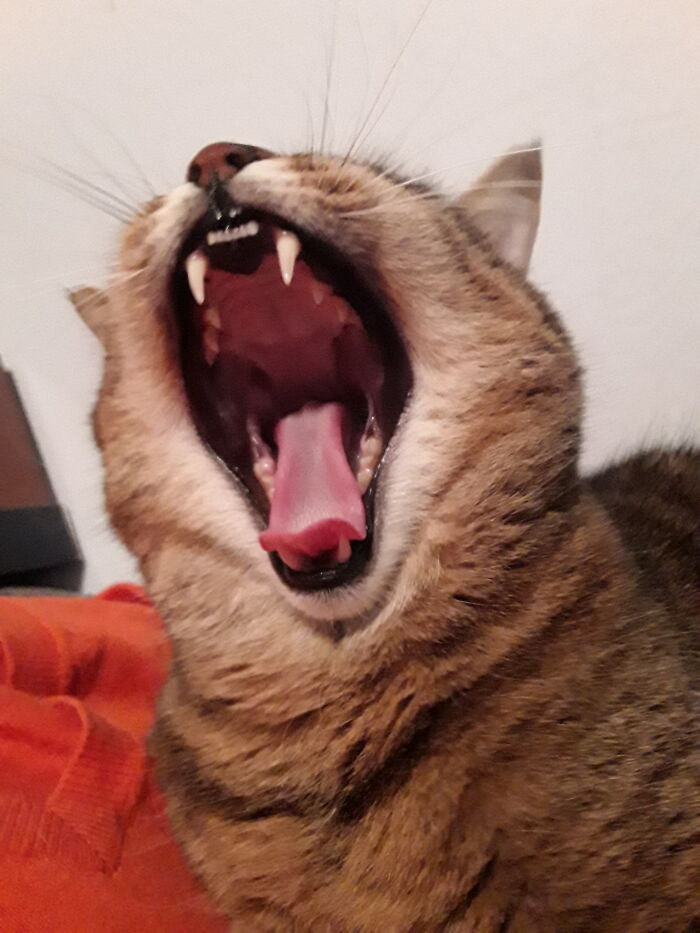 Sooo Tiring To Yawn This Big