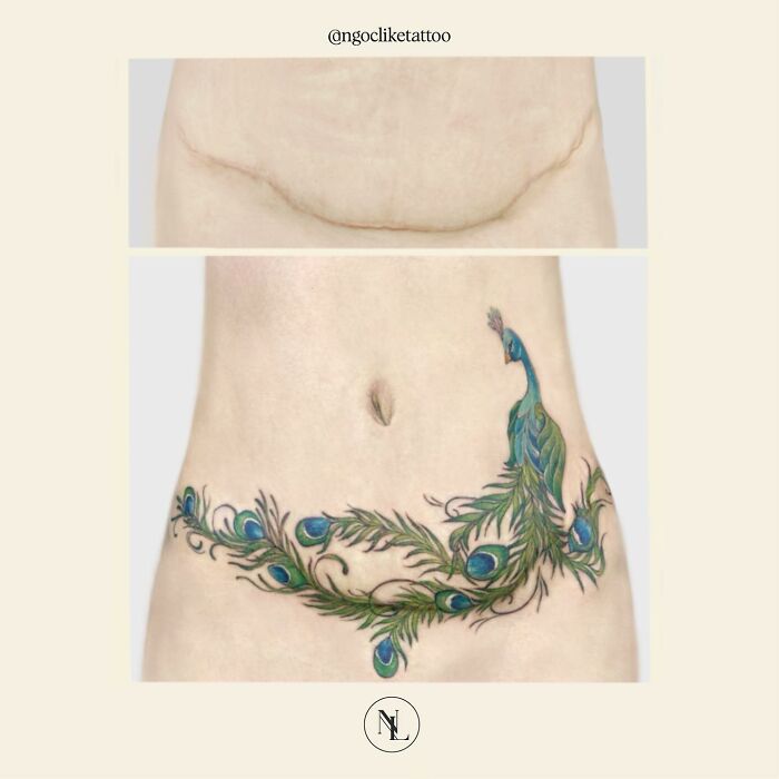 50 Times People Asked To Cover Up Their Scars, And This Tattoo Artist Nailed It (New Pics)