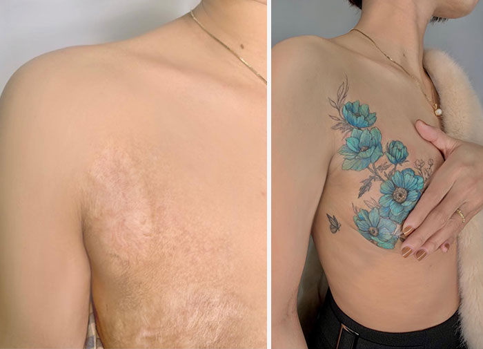 50 Times People Asked To Cover Up Their Scars, And This Tattoo Artist Nailed It (New Pics)