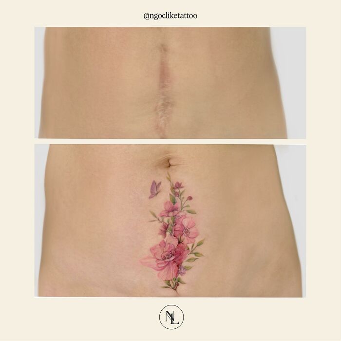 50 Times People Asked To Cover Up Their Scars, And This Tattoo Artist Nailed It (New Pics)