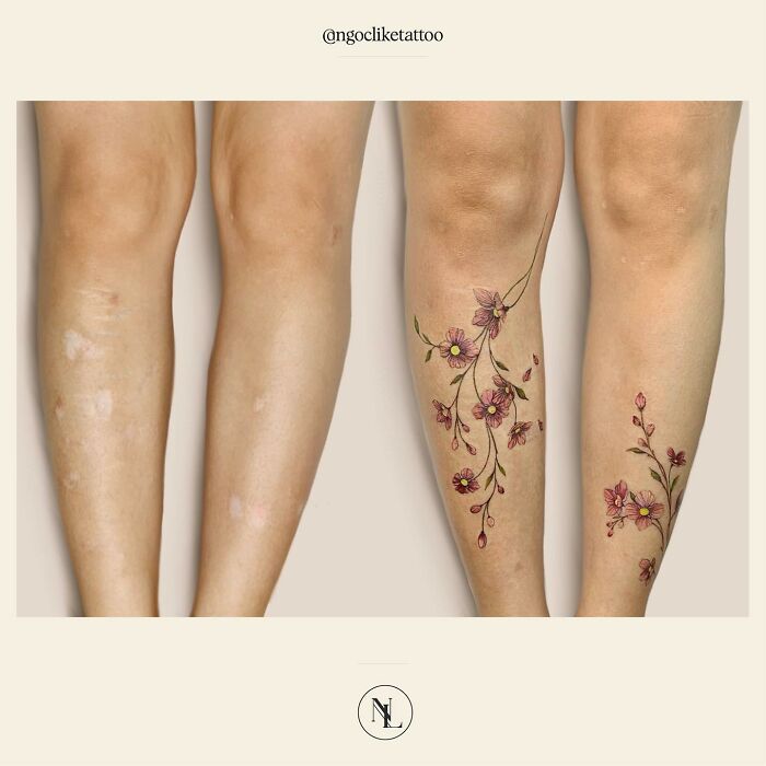 50 Times People Asked To Cover Up Their Scars, And This Tattoo Artist Nailed It (New Pics)