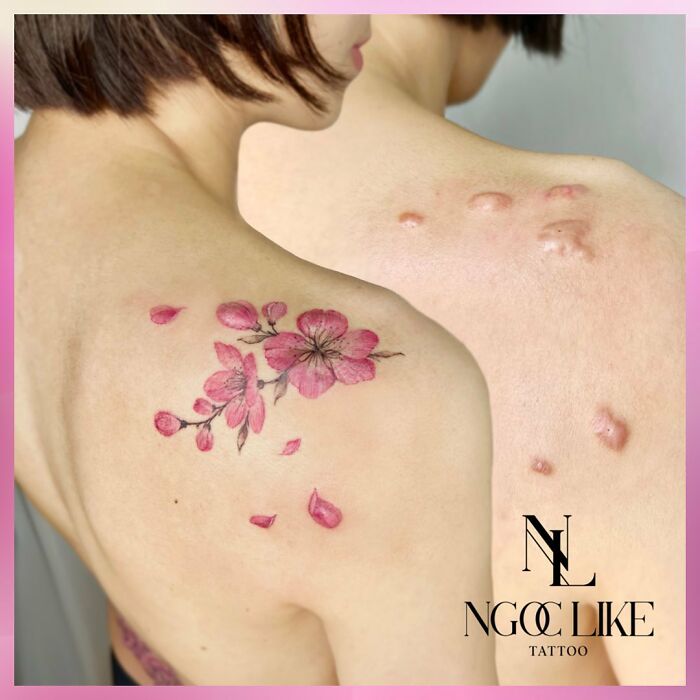 50 Times People Asked To Cover Up Their Scars, And This Tattoo Artist Nailed It (New Pics)