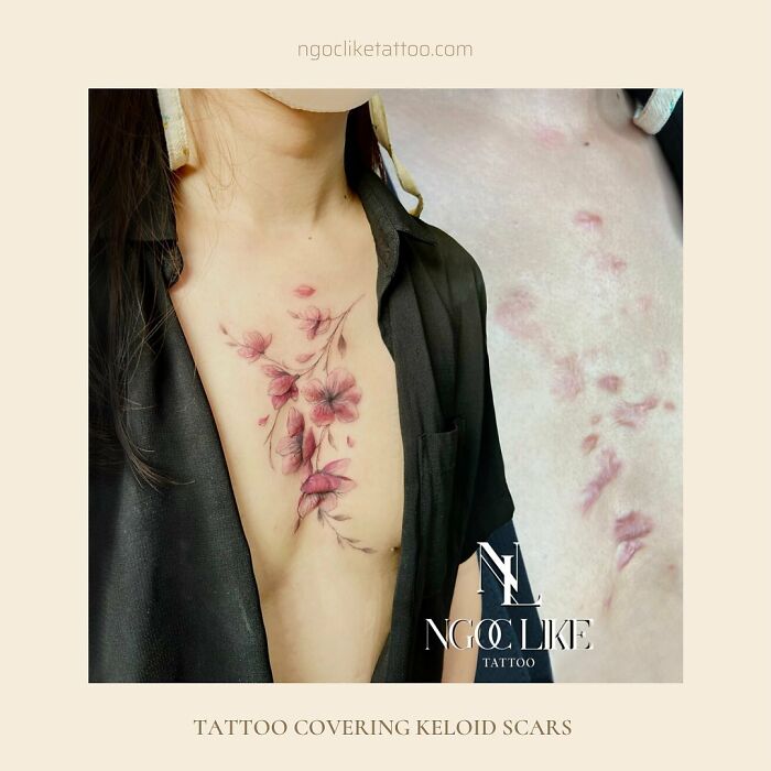 50 Times People Asked To Cover Up Their Scars, And This Tattoo Artist Nailed It (New Pics)