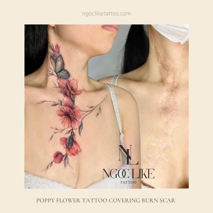 50 Times People Asked To Cover Up Their Scars, And This Tattoo Artist Nailed It (New Pics)