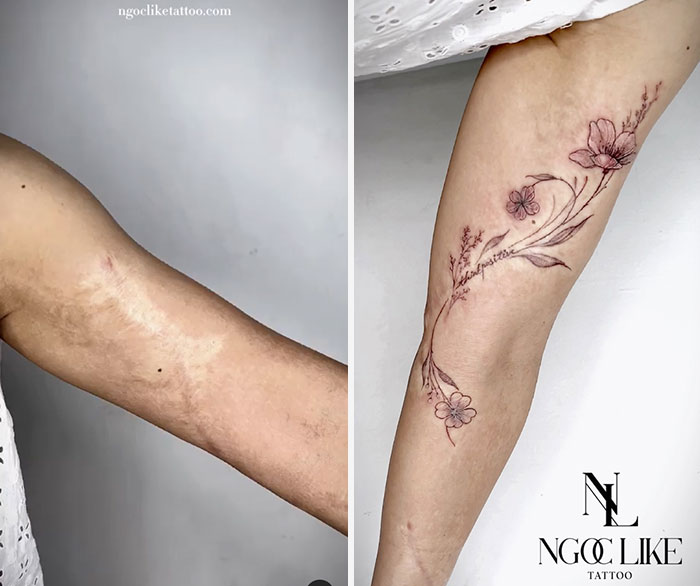 50 Times People Asked To Cover Up Their Scars, And This Tattoo Artist Nailed It (New Pics)