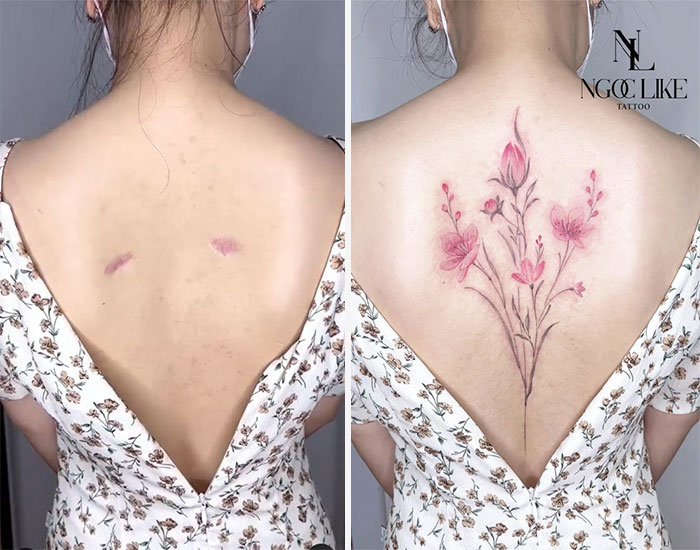 50 Times People Asked To Cover Up Their Scars, And This Tattoo Artist Nailed It (New Pics)