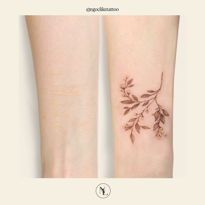 50 Times People Asked To Cover Up Their Scars, And This Tattoo Artist Nailed It (New Pics)