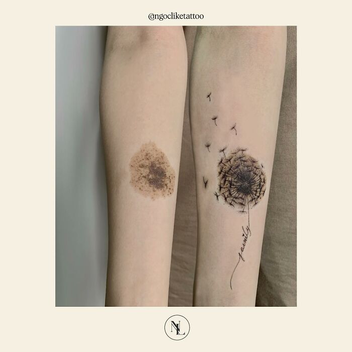 50 Times People Asked To Cover Up Their Scars, And This Tattoo Artist Nailed It (New Pics)