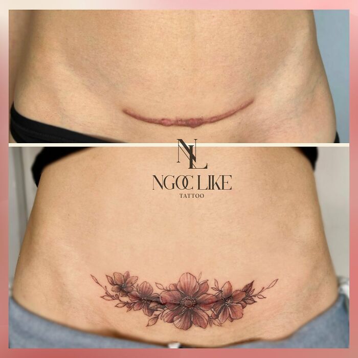 50 Times People Asked To Cover Up Their Scars, And This Tattoo Artist Nailed It (New Pics)