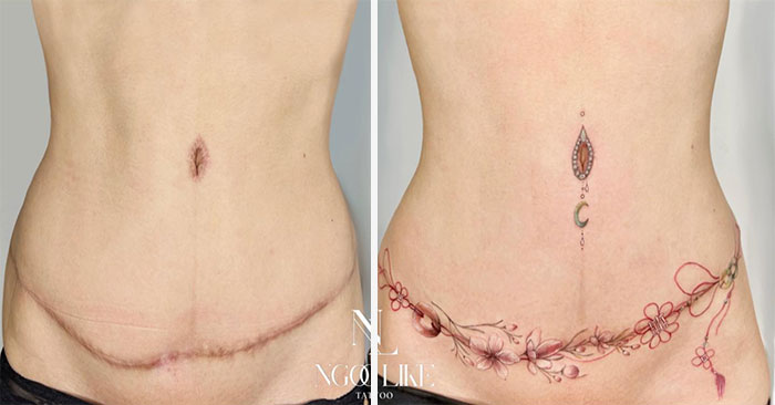 50 Times People Asked To Cover Up Their Scars, And This Tattoo Artist Nailed It (New Pics)