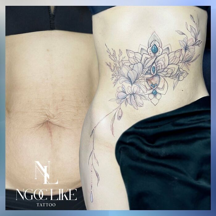 50 Times People Asked To Cover Up Their Scars, And This Tattoo Artist Nailed It (New Pics)