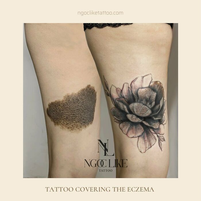 50 Times People Asked To Cover Up Their Scars, And This Tattoo Artist Nailed It (New Pics)