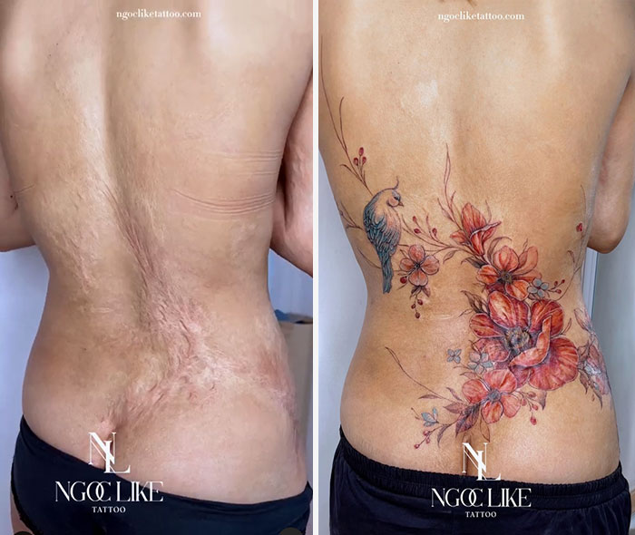 50 Times People Asked To Cover Up Their Scars, And This Tattoo Artist Nailed It (New Pics)