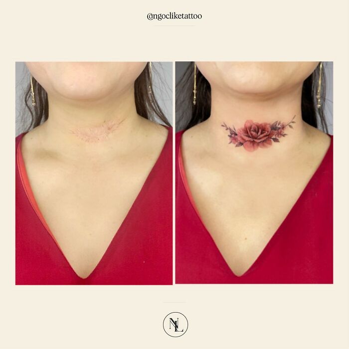 50 Times People Asked To Cover Up Their Scars, And This Tattoo Artist Nailed It (New Pics)