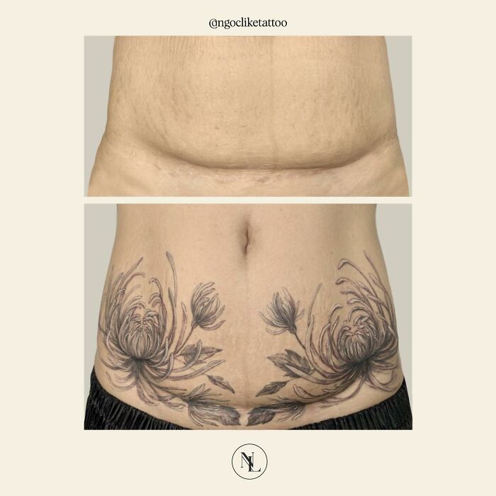 50 Times People Asked To Cover Up Their Scars, And This Tattoo Artist Nailed It (New Pics)