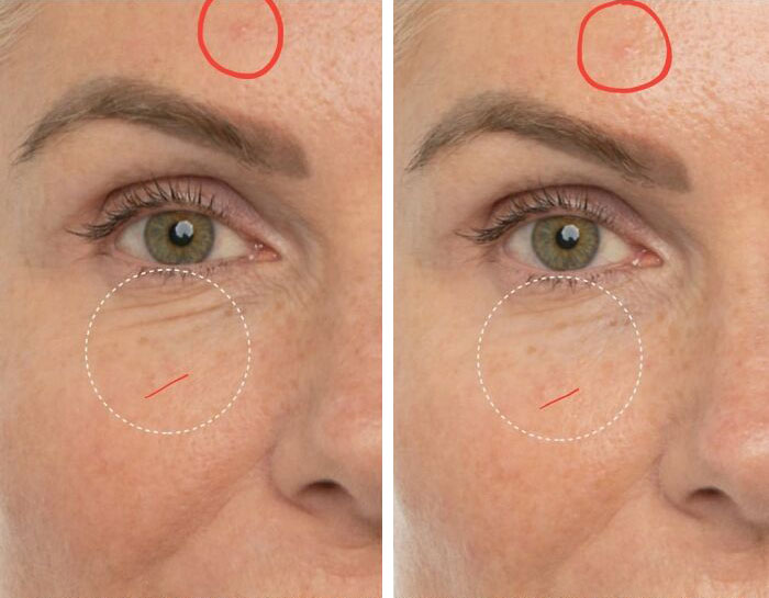 Close-up comparison of an eye area showing subtle differences in skin texture, highlighting Instagram reality fake pictures.