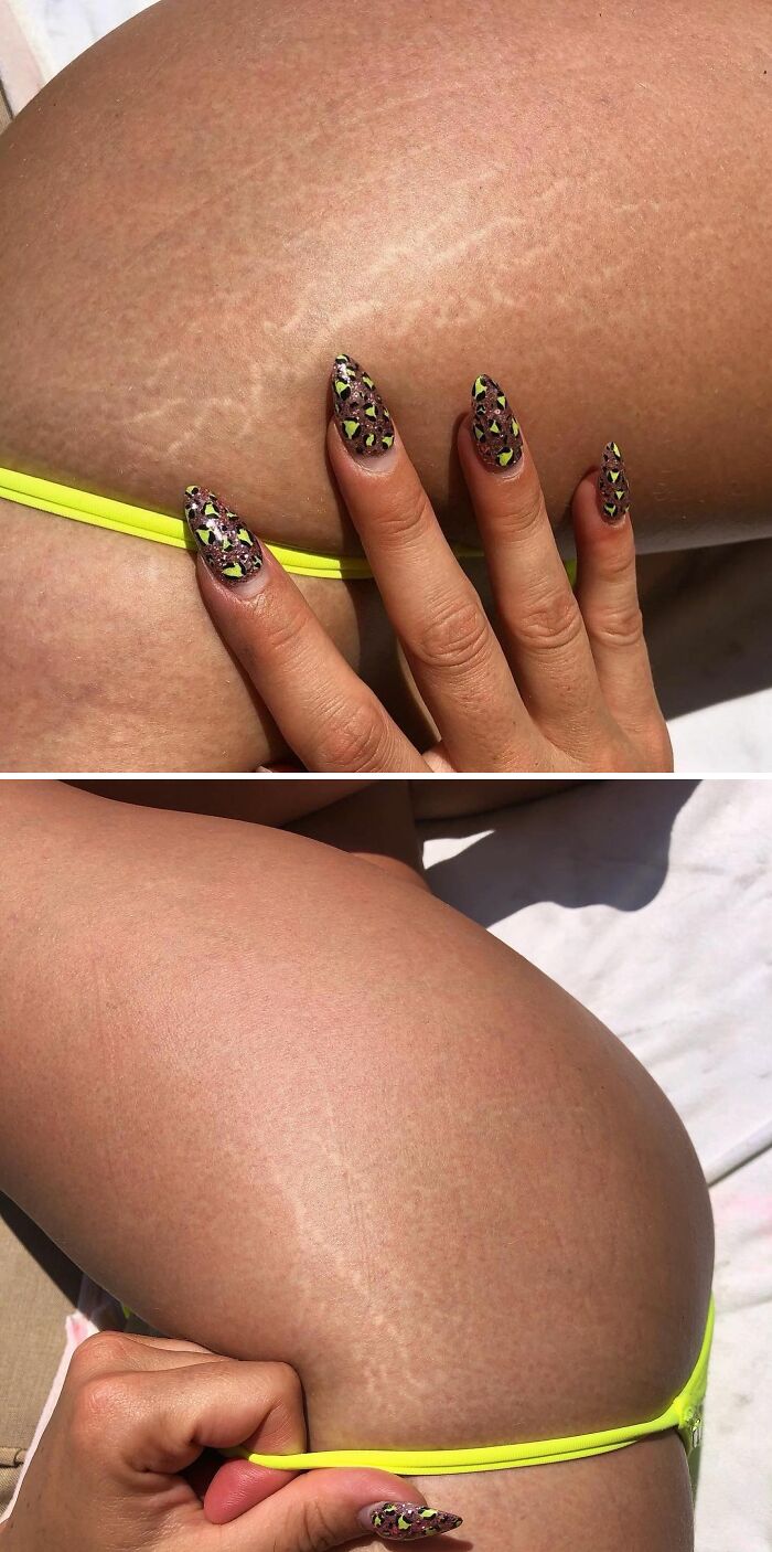 When Beauty Influencer Kandee Johnson Talked About How Beautiful Her "Thighlights" Are