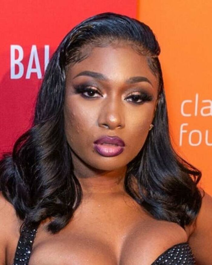 Does She Have Uneven Texture? Sure. Is She Still Beautiful? Yes