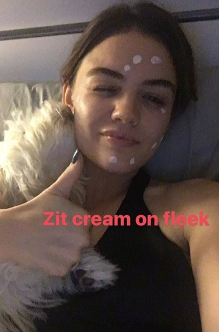 When Lucy Hale Smiled For The Camera With Her "Zit Cream On Fleek"