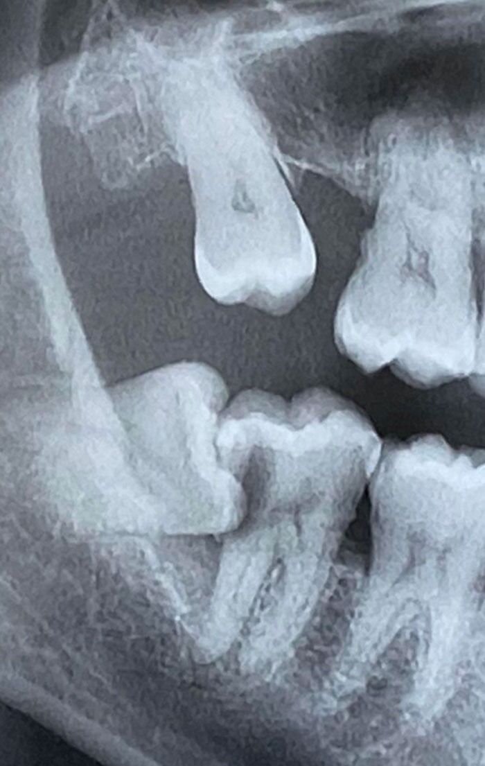 Have A Guess How Much Pain I’m In