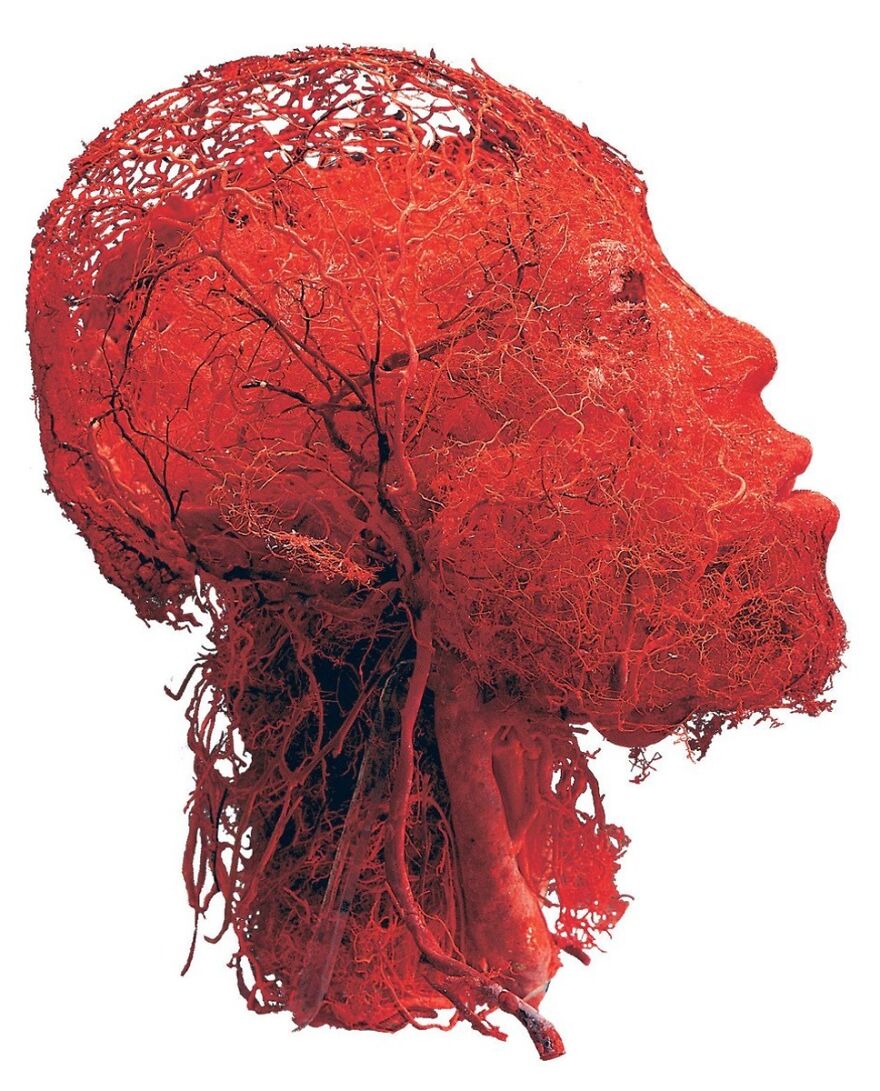 All The Blood Vessels In Your Head All The Blood Vessels In Your Head
